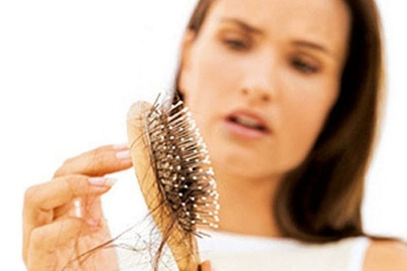 Làm sao để khắc phục tình trạng hói đỉnh đầu nữ?