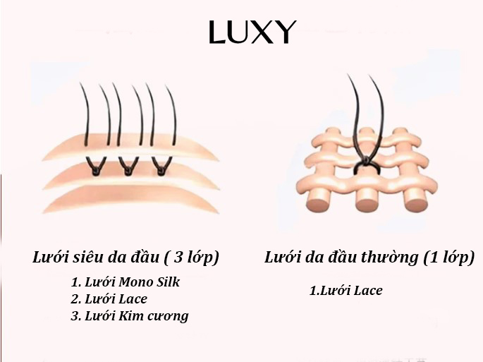 Đặc điểm của lưới tóc giả